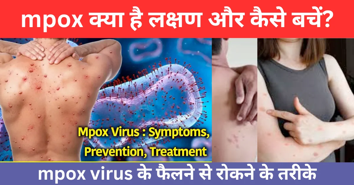 mpox kya hai, mpox virus kaise failta hai, m pox se kaise bache